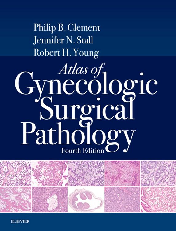 Produktbild: Atlas of Gynecologic Surgical Pathology E-Book