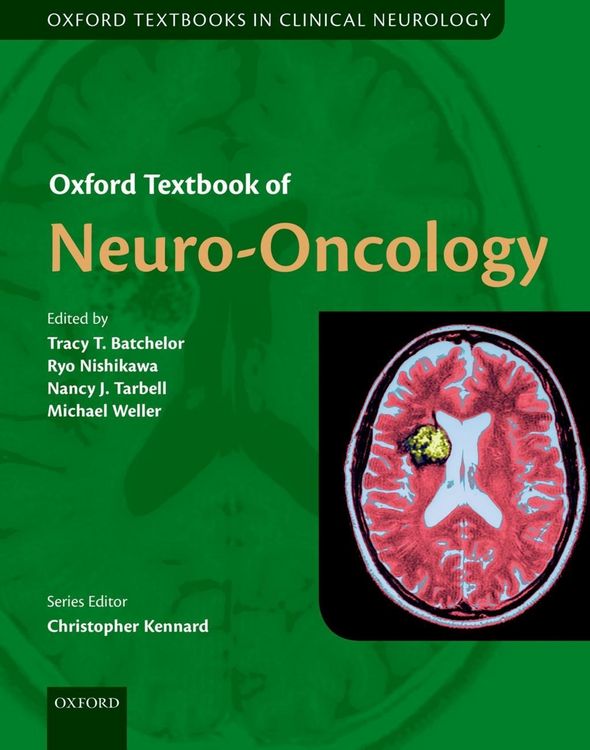 Produktbild: Oxford Textbook of Neuro-Oncology