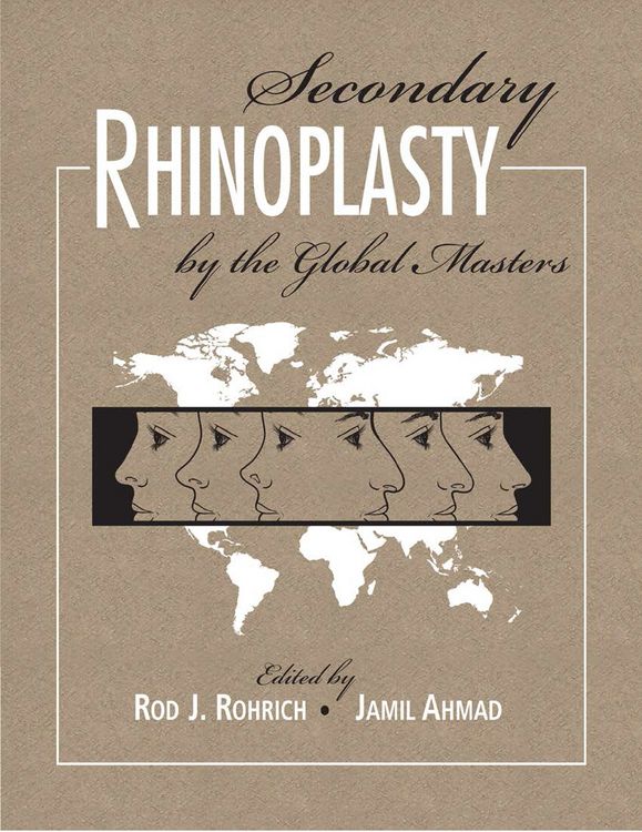 Produktbild: Secondary Rhinoplasty by the Global Masters