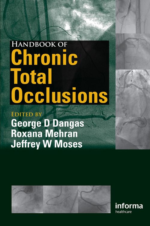 Produktbild: Handbook of Chronic Total Occlusions
