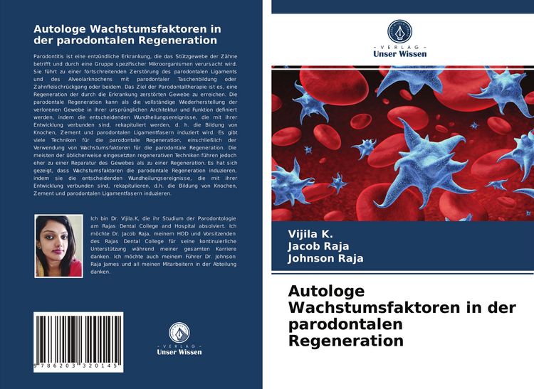 Produktbild: Autologe Wachstumsfaktoren in der parodontalen Regeneration