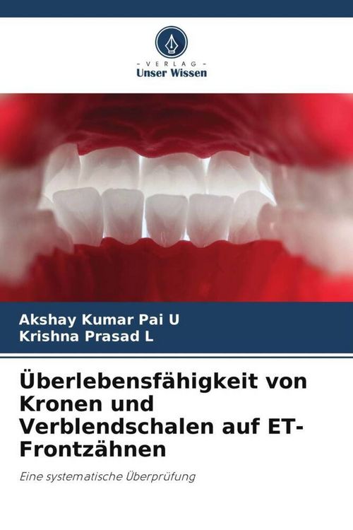 Produktbild: &Uuml;berlebensf&auml;higkeit von Kronen und Verblendschalen auf ET-Frontz&auml;hnen