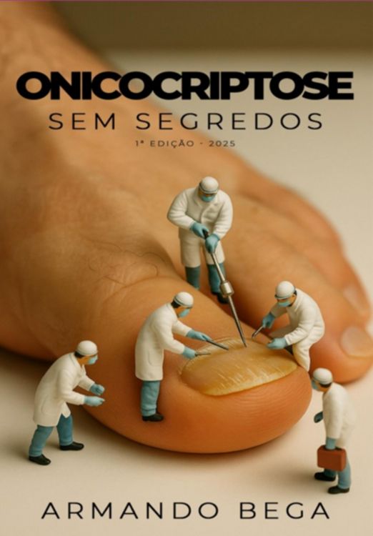 Produktbild: Onicocriptose Sem Segredos