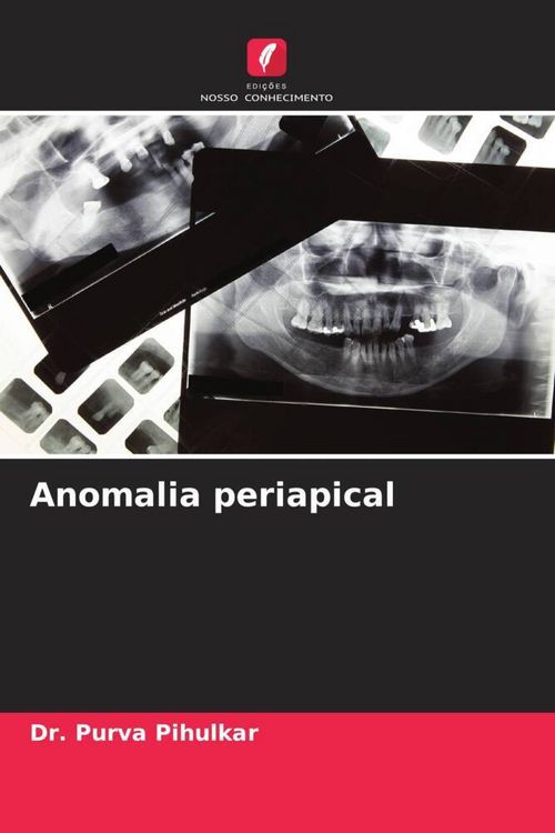 Produktbild: Anomalia periapical