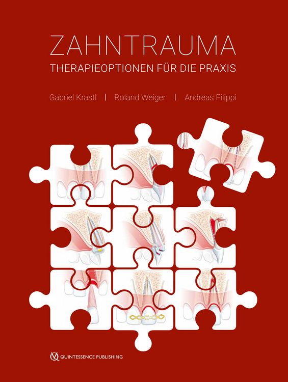 Produktbild: Zahntrauma