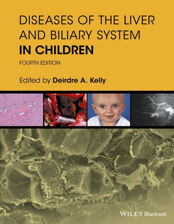 Produktbild: Diseases of the Liver and Biliary System in Children