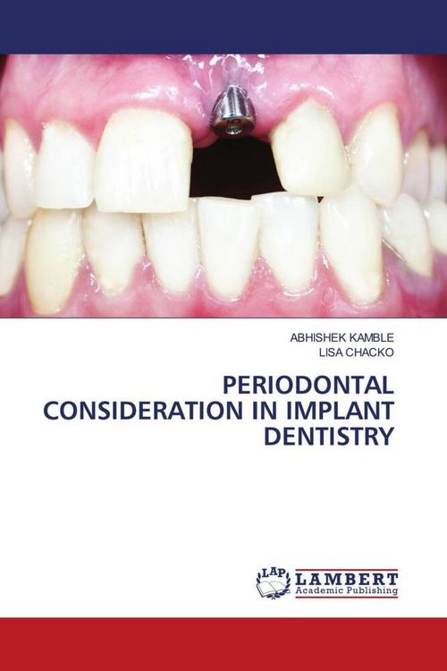 Produktbild: Periodontal Consideration in Implant Dentistry