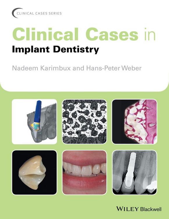 Produktbild: Clinical Cases in Implant Dentistry