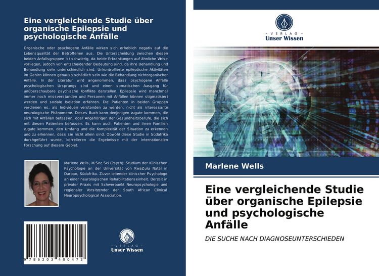 Produktbild: Eine vergleichende Studie &uuml;ber organische Epilepsie und psychologische Anf&auml;lle