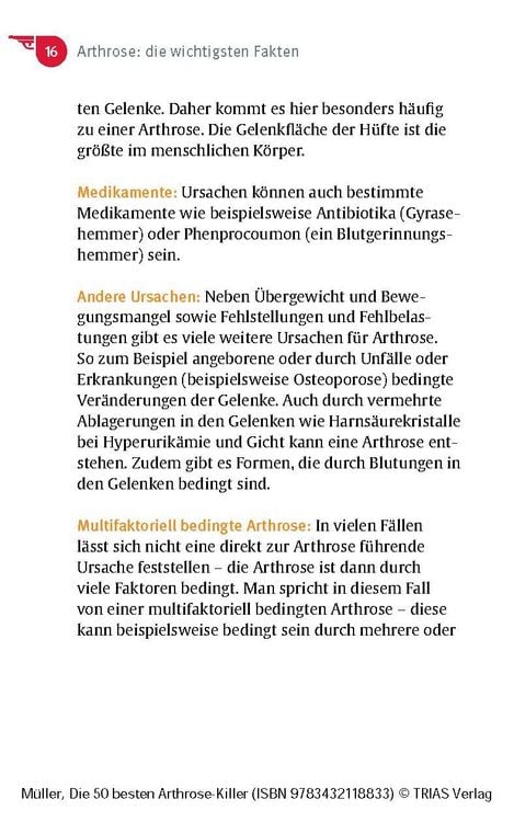 Produktbild: Die 50 besten Arthrose-Killer