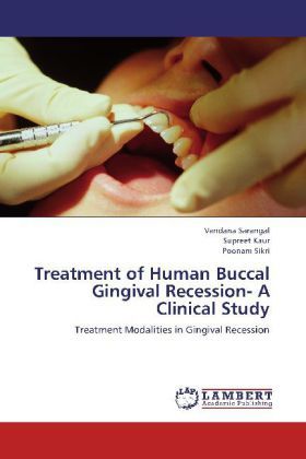 Produktbild: Sarangal, V: Treatment of Human Buccal Gingival Recession- A