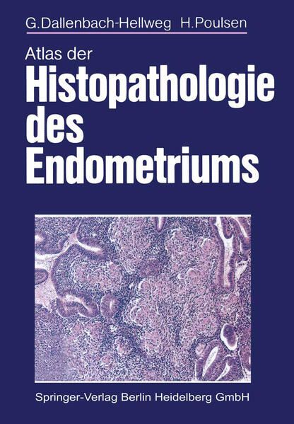 Produktbild: Atlas der Histopathologie des Endometriums