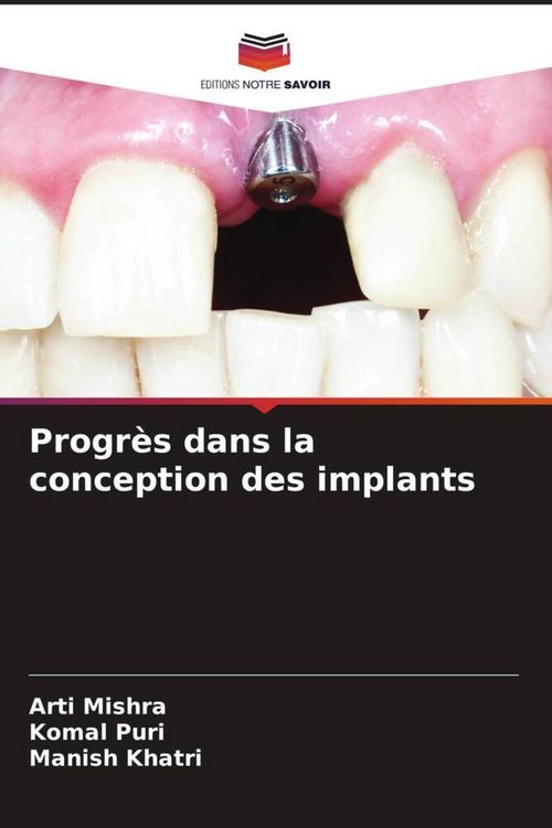 Produktbild: Progr&egrave;s dans la conception des implants