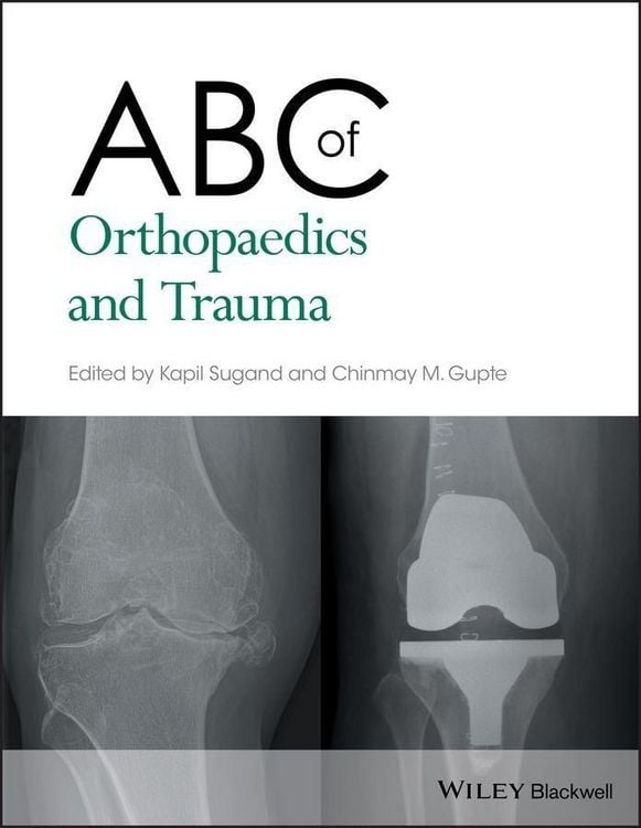 Produktbild: ABC of Orthopaedics and Trauma