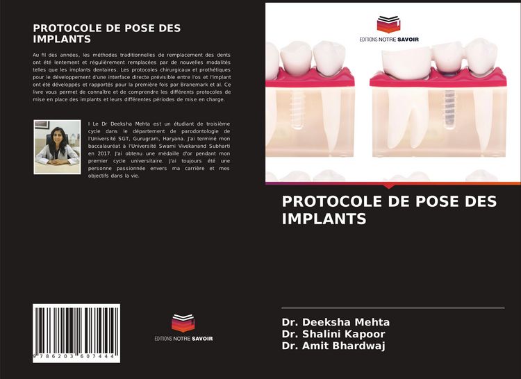 Produktbild: Protocole De Pose des Implants