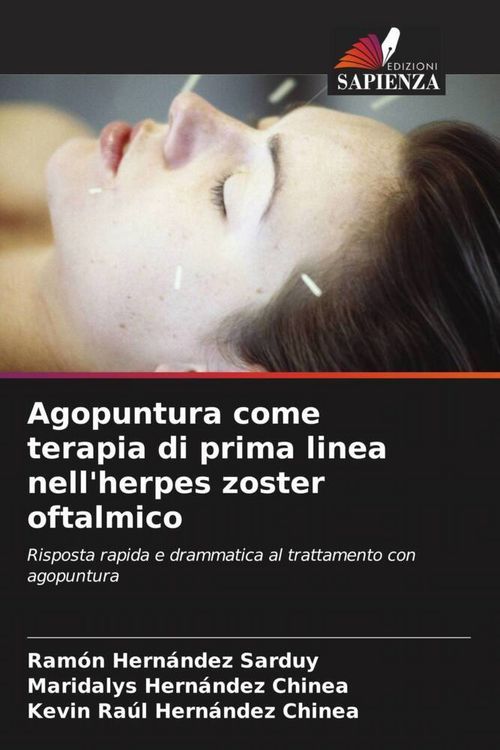 Produktbild: Agopuntura come terapia di prima linea nell'herpes zoster oftalmico