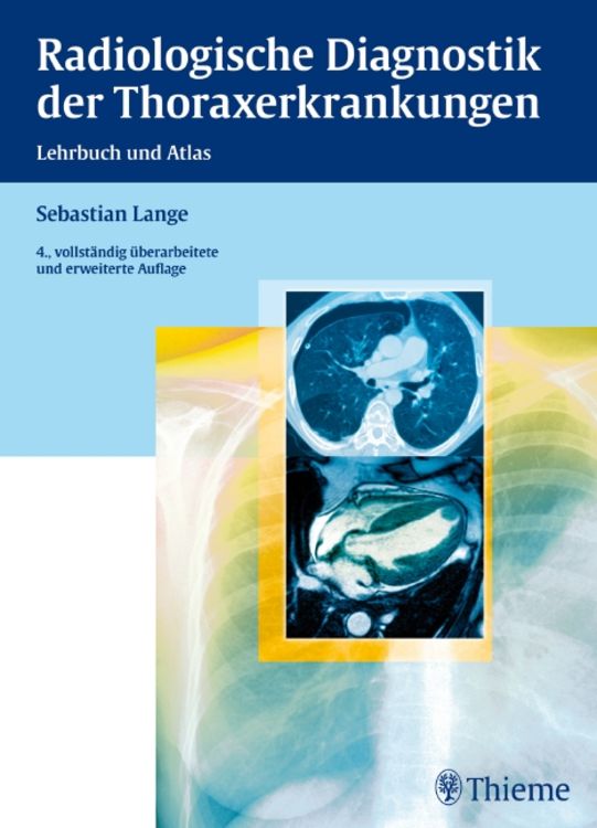 Produktbild: Radiologische Diagnostik der Thoraxerkrankungen
