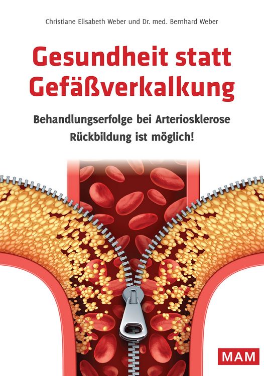 Produktbild: Gesundheit statt Gef&auml;&szlig;verkalkung