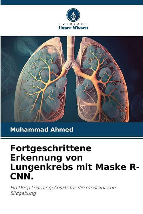 Produktbild: Fortgeschrittene Erkennung von Lungenkrebs mit Maske R-CNN.