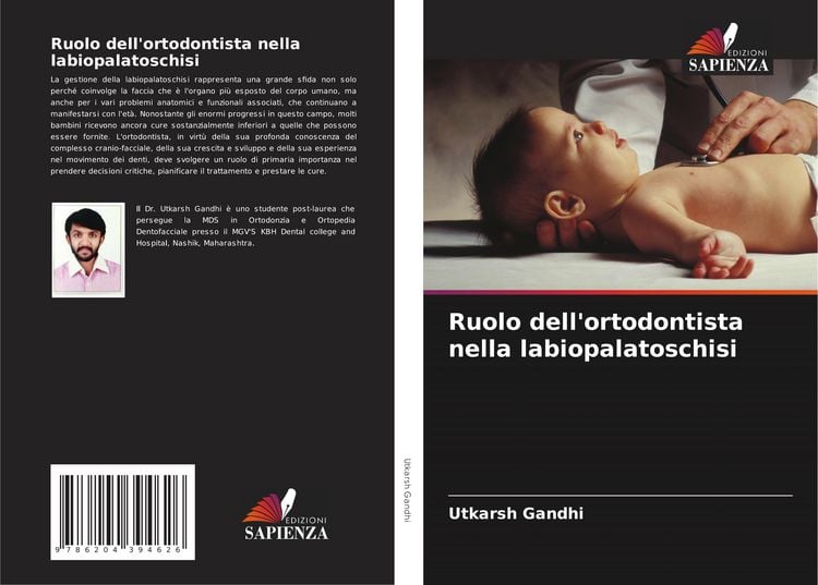 Produktbild: Ruolo dell'ortodontista nella labiopalatoschisi