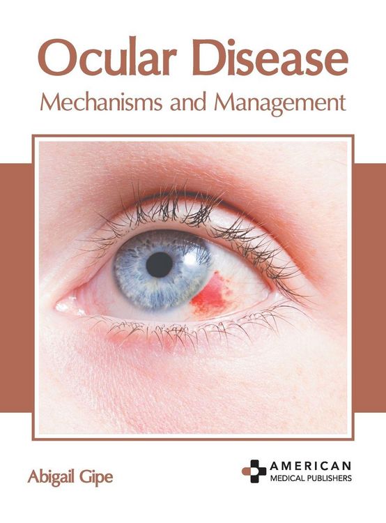 Produktbild: Ocular Disease: Mechanisms and Management