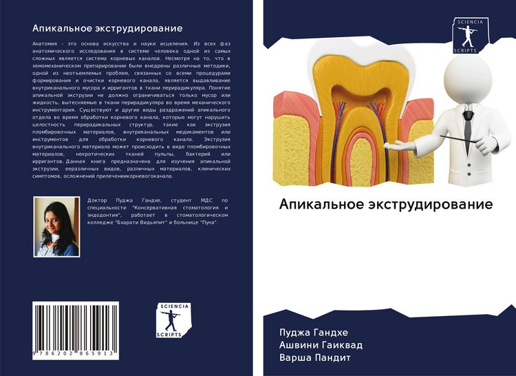 Produktbild: Apikal'noe &auml;xtrudirowanie