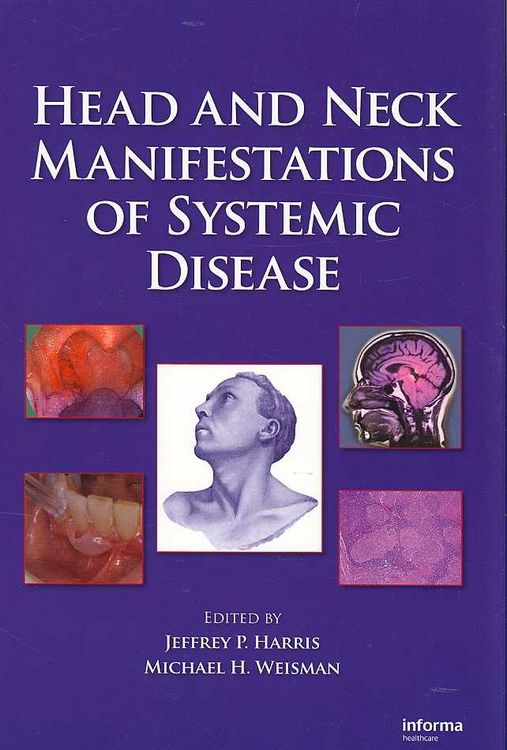 Produktbild: Head and Neck Manifestations of Systemic Disease