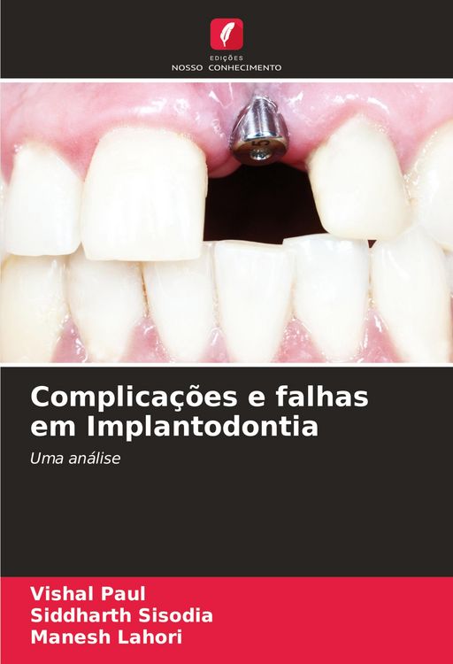 Produktbild: Complica&ccedil;&otilde;es e falhas em Implantodontia