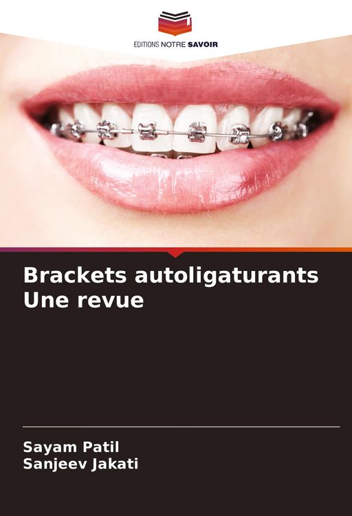 Produktbild: Brackets autoligaturants Une revue