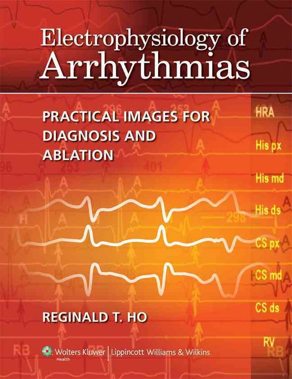 Produktbild: Ho, R: Electrophysiology of Arrhythmias