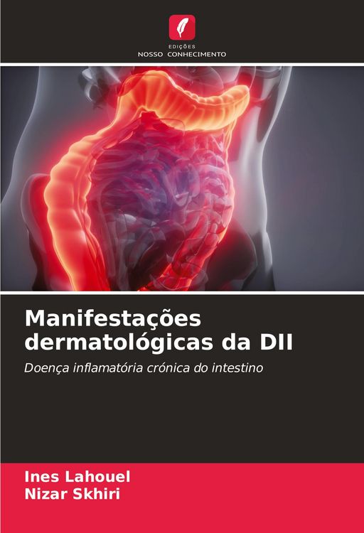 Produktbild: Manifesta&ccedil;&otilde;es dermatol&oacute;gicas da DII
