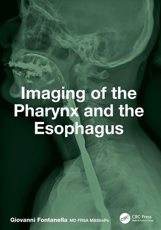 Produktbild: Imaging of the Pharynx and the Esophagus