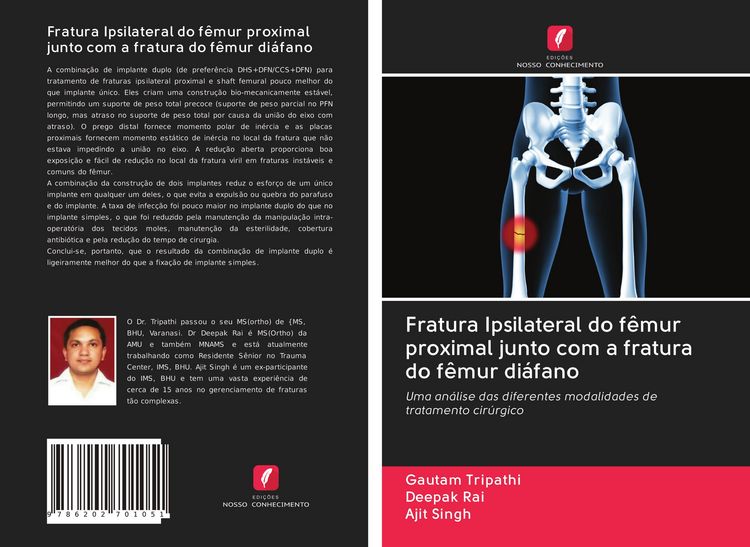 Produktbild: Fratura Ipsilateral do f&ecirc;mur proximal junto com a fratura do f&ecirc;mur di&aacute;fano