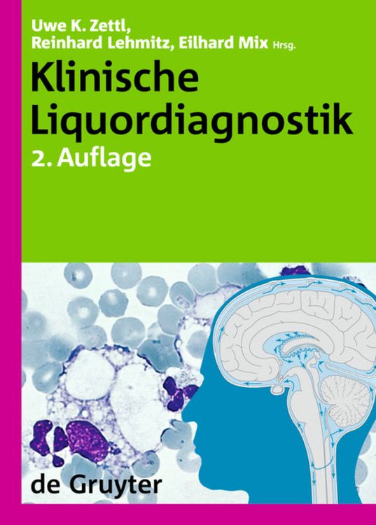 Produktbild: Klinische Liquordiagnostik