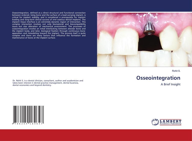 Produktbild: Osseointegration