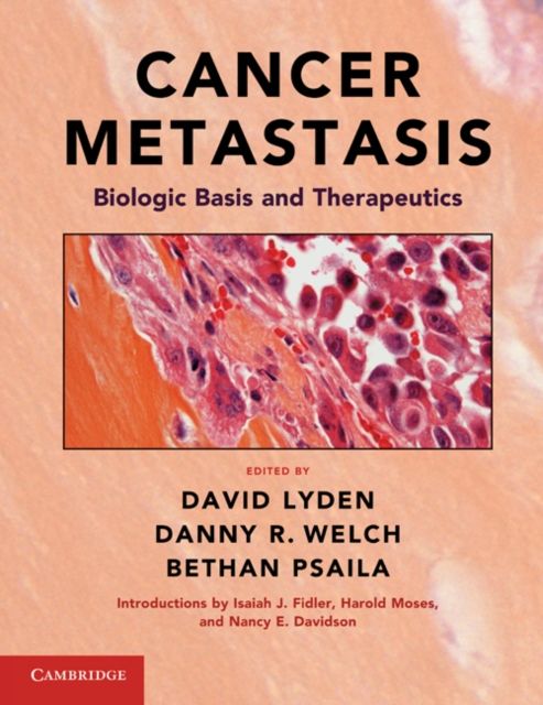 Produktbild: Cancer Metastasis