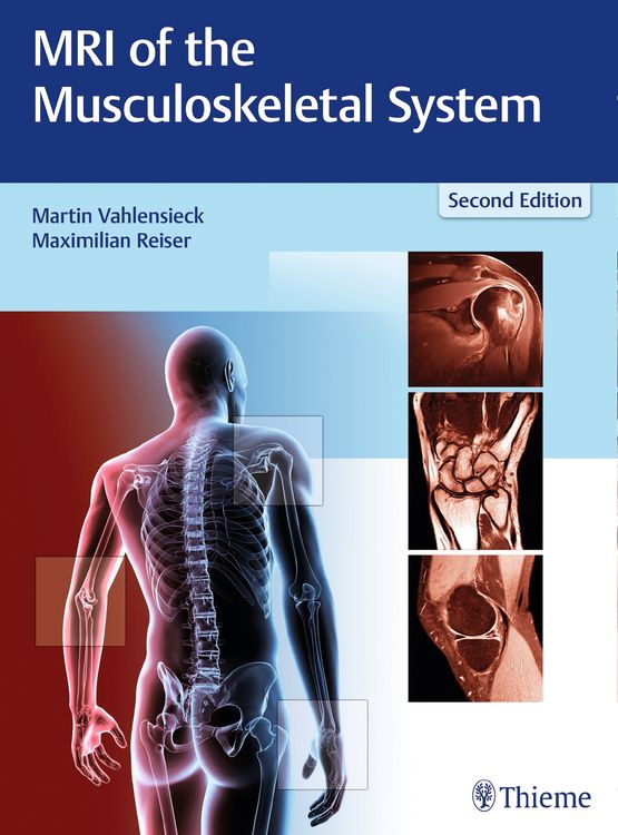 Produktbild: MRI of the Musculoskeletal System