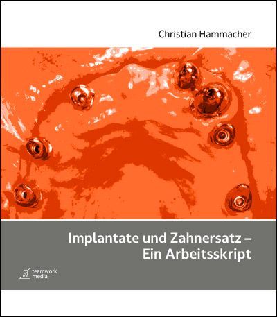 Produktbild: Implantate und Zahnersatz - Ein Arbeitsskript
