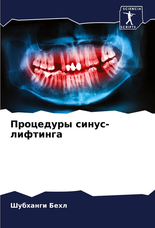 Produktbild: Procedury sinus-liftinga