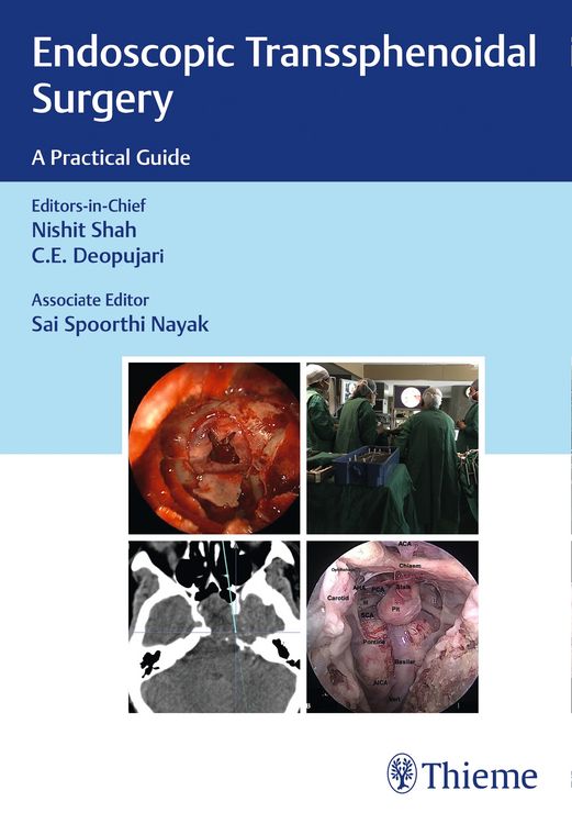 Produktbild: Endoscopic Transsphenoidal Surgery