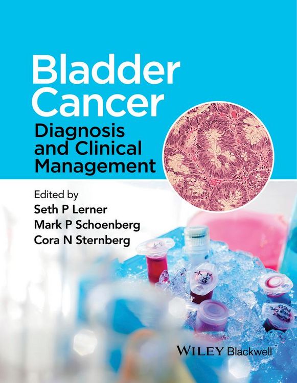 Produktbild: Bladder Cancer