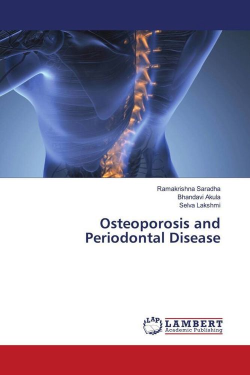 Produktbild: Osteoporosis and Periodontal Disease