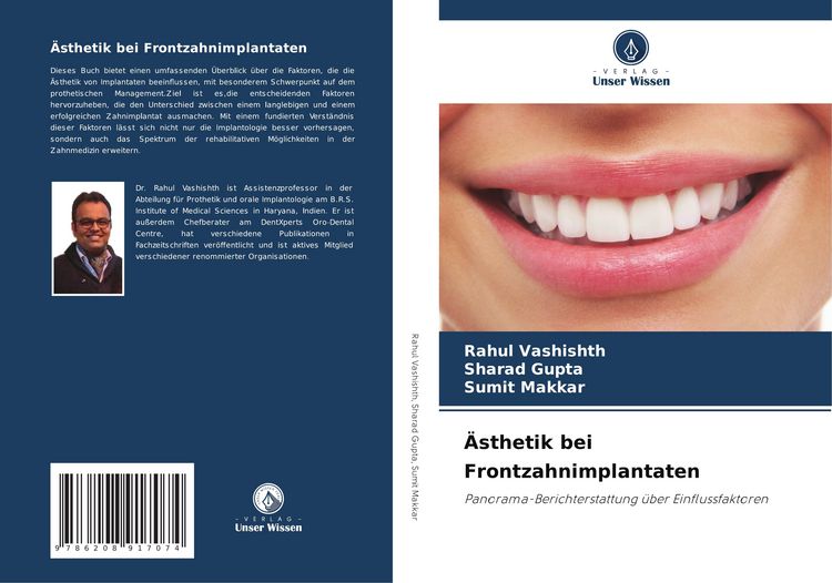 Produktbild: &Auml;sthetik bei Frontzahnimplantaten