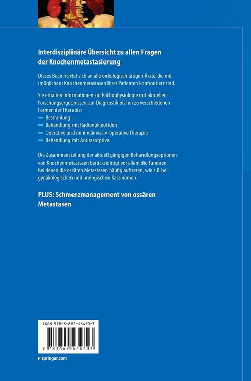 Produktbild: Knochenmetastasen