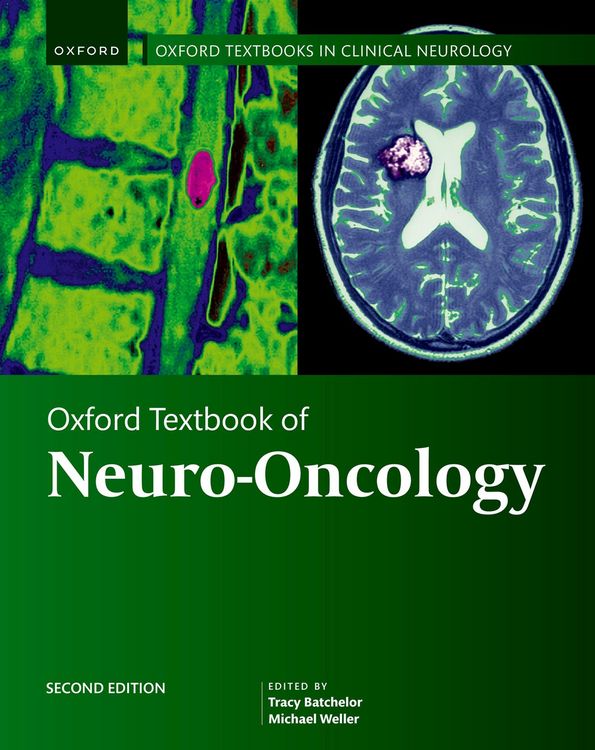 Produktbild: Oxford Textbook of Neuro-Oncology