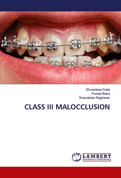 Produktbild: CLASS III MALOCCLUSION