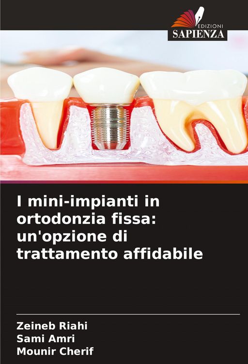 Produktbild: I mini-impianti in ortodonzia fissa: un'opzione di trattamento affidabile