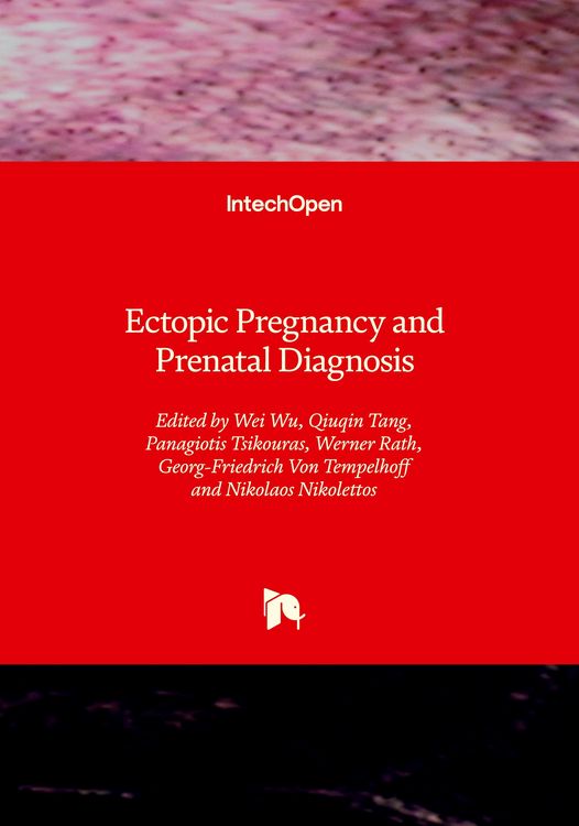 Produktbild: Ectopic Pregnancy and Prenatal Diagnosis
