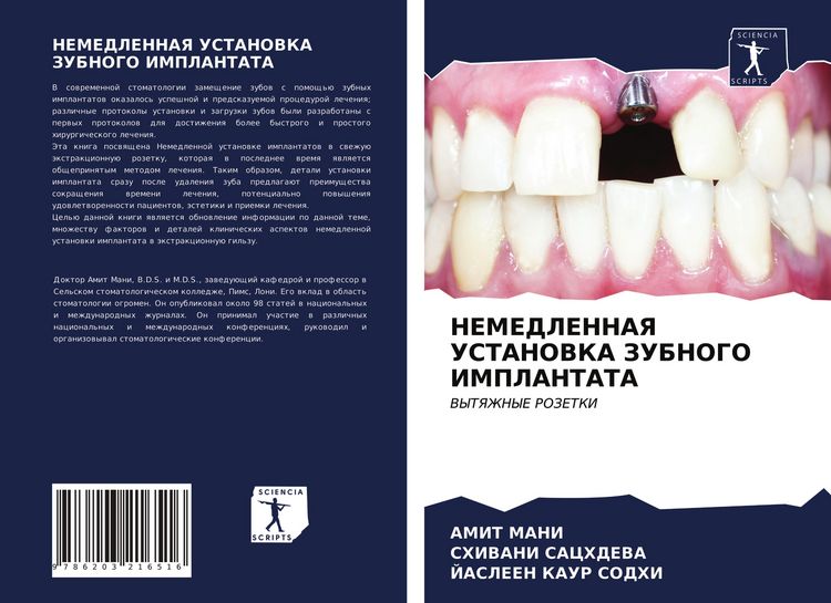 Produktbild: Nemedlennaya Ustanovka Zubnogo Implantata
