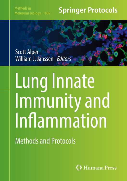 Produktbild: Lung Innate Immunity and Inflammation